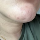 병점경희한의원 | 병점 여드름 체질개선 확실히 달라요