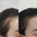 헤어스케치 M