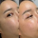 촉촉한 속건조해결템 에스터 하닷사 보검선인장 에센스
