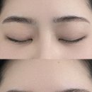 상담주차장 - 우 | 성남 분당 야탑 잔흔제거 리니끄브로우 눈썹문신제거 2회차 통증 가격 후기