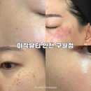 미작프렌차이즈 | 구월동[미작뷰티 인천점] 기미/주근깨 제거하는 곳 | 잡티제거 솔직 후기