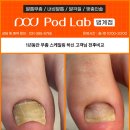범계 발톱무좀, 포디랩의 꾸준한 관리로 개선된 발톱무좀 전후 이미지