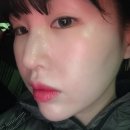 도리한의원 | 코실리프팅 코끝높이기 뷰티코성형으로 단번에 해결한 후기