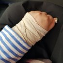 불리한 시바 | 호르몬양성 유방암 항호르몬제 치료 페마라 졸라덱스 한달 후기