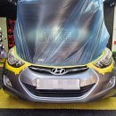 스피젠 | 대전라이트복원 완전 새거 됐어요