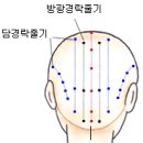 핸드경락 이미지