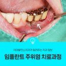 송정발전소 이미지