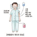 패혈증 이미지