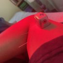 테니스 엘보로 고생하다가 짱짱해진 썰.