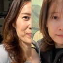 사진으로 본 새로운 세상 | 무통 울쎄라 통증, 수면 마취 안하고 효과 본 후기