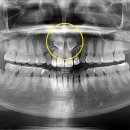 비우고채우는치과의원 이미지