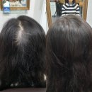 최민헤어샾 | 메이모 여자 앞머리 증모술 머리숱없는 헤어의 변신 성공 시술후기