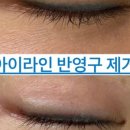 율스킨스토리