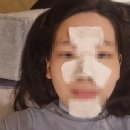 [서울/강서구피부과]가양역에 새로생긴 뷰커스의원 내돈내산 1회차 후기(리쥬란힐러 후기)