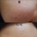 뷰제닉