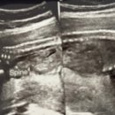 참여성병원 이미지