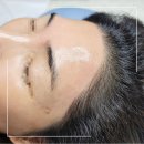 썬헤어라인 이미지