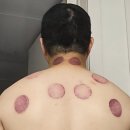 세종로한의원 | 아프니까 사장이다. 목 어깨 통증치료 / 여주 김한의원 방문기