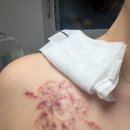 드림21피부과의원 | [내돈내산] 대전 둔산동 피부과 추천 문신(타투) 제거 후기 2️⃣