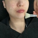 천안성성초등학교 | [천안 성성동 피부관리] 이벨 크라이오 블랙헤드 관리 후기