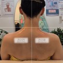 지하철 동의대역 | 부산승모근관리 부산예신관리 추천 예뻐졌다 동의대역점