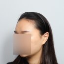 모원성형외과의원 이미지