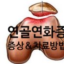 연골 이미지