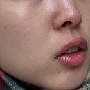 레이첼의원 이미지