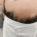 라비에벨뷰티 네이버블로그