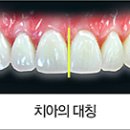 스마일 라인 치과기공소 이미지