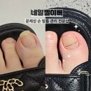 송도공영주차장 02140 | [뷰티 리뷰] 송도 내성발톱 전문 샵 네일젤이뻐 관리 후기
