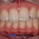 아이콘치과교정과의원 네이버블로그