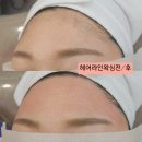 헤어송(HAIR SONG) - 포항시 남구 | 청주 헤어라인왁싱, 자연스럽게 예뻐지는 방법 송앤뷰티