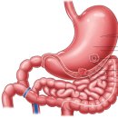 C16 | 위장간간질종양(GIST) 보험금 D37.1에서 C16으로 바꿔서 진단금 받은 후기