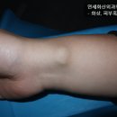 연세화산외과 이미지