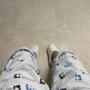 제왕절개 4일차 대구 계명대 동산병원