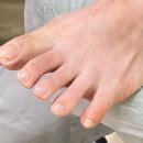 오니크네일 이미지