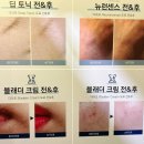 로브에스테틱 | [충주 마사지샵 후기] 로브에스테틱 : 충주 연수동 20년 경력 얼굴윤곽 축소 근막테라피 경락마사지 후기!