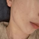 그린필스킨케어 이미지