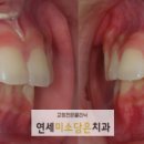 연세미소담은치과 이미지