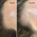일번가헤어라인