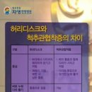 [척추관협착증] 척추관협착증의 원인과증상/척추관협착증 치료방법 이미지