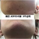 (주)바이오리듬 | 이런 피부 어케 살리죠…지금 고딩이고 중딩때브터 트러블이 나긴 했는데 점점더 심해져요ㅜㅜ 좋다는거...