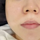 힐바이오 | 대전에스테틱 추천 프롬미 대전점 바이오힐 관리 후기