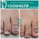 위드유네일