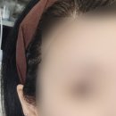 쑥피어싱 이미지