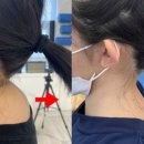 M체형교정&PT 이미지