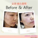 GS25 달서상인점 | [대구/달서구 상인동] 예민한 다이버 피부도 순하게, 효과는 확실하게! 소연에스테틱 진정재생 피부관리
