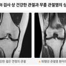 올바로 이미지