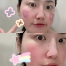 오약국 | 약국템 '오랩스 미네랄 클렌징 세럼' 딥클렌징 사용후기